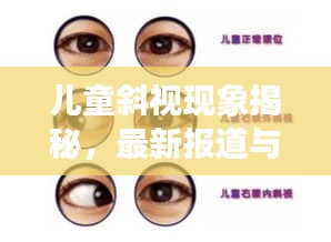 兒童斜視現(xiàn)象揭秘，最新報(bào)道與深度解析