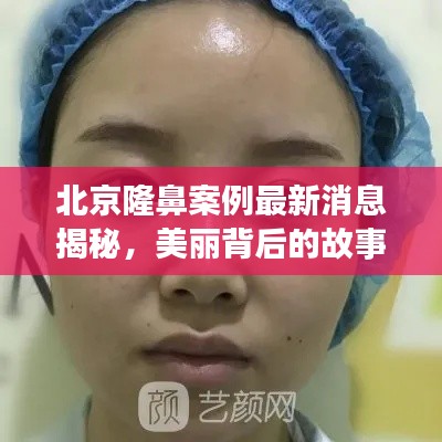 北京隆鼻案例最新消息揭秘，美麗背后的故事！