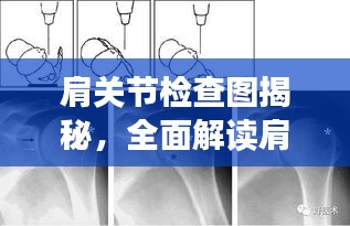 肩關(guān)節(jié)檢查圖揭秘，全面解讀肩關(guān)節(jié)健康與功能狀態(tài)