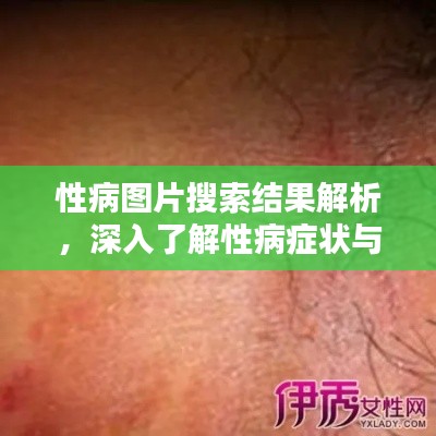 性病圖片搜索結(jié)果解析，深入了解性病癥狀與防治知識(shí)